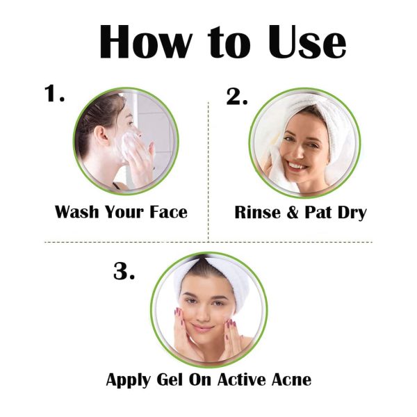 Vigini 35% Actives Anti Acne Pits & Scars Gel (20 ml) - Image 4